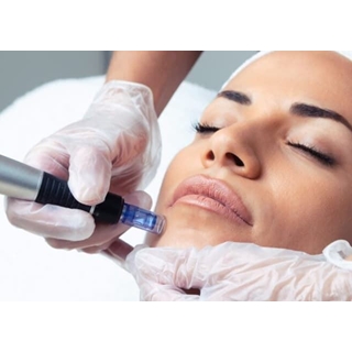 Regalos Navidad Facial Rejuvenecimiento Exosomas con Dermapen - Imagen 1
