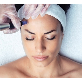 Rejuvenecimiento Facial con Exosomas - Imagen 1