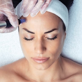 Rejuvenecimiento Facial con Exosomas - Imagen 1